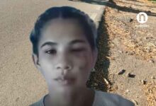 “Me dejaron destrozada” joven víctima de riña en Montería